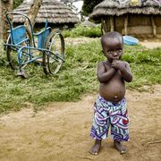 Oltre la disabilità, in Uganda: il sorriso ritrovato di Ocean, Margaret e altre 40mila persone