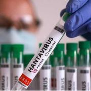 Hantavirus, ecco le misure per prevenire la diffusione del virus