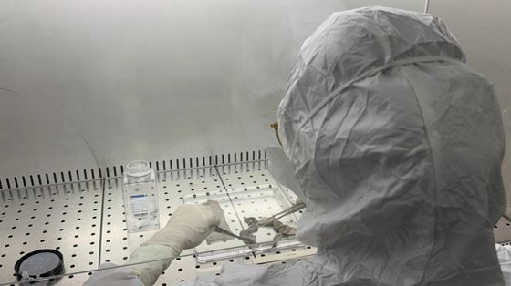 Il tesoro nascosto delle "banche della pelle"