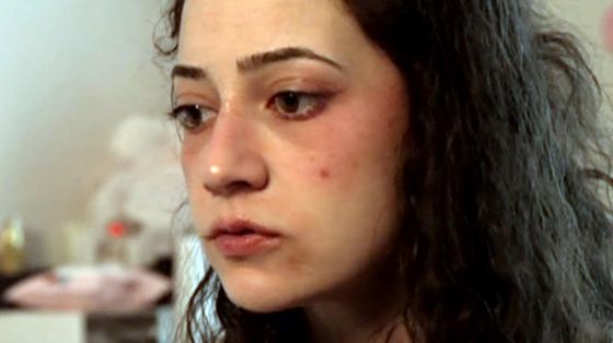 L’eutanasia di Noelia, paraplegica: la Spagna si interroga sulla morte per chi soffre