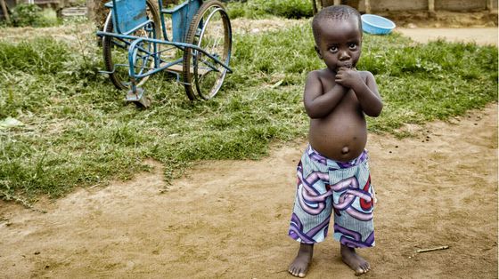 Oltre la disabilità, in Uganda: il sorriso ritrovato di Ocean, Margaret e altre 40mila persone