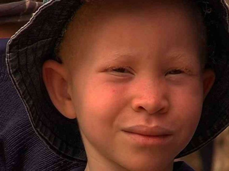 «Albini, in Africa massacro senza precedenti»