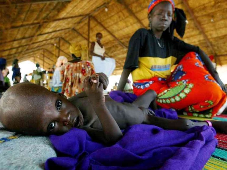 Denutrizione prima malattia dei bimbi in Niger