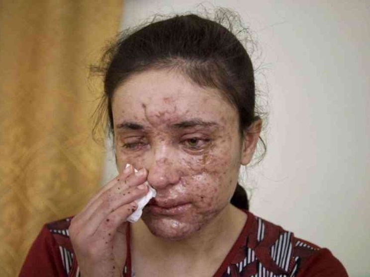 La voce di un popolo invisibile: l’Occidente non può «ignorarle»