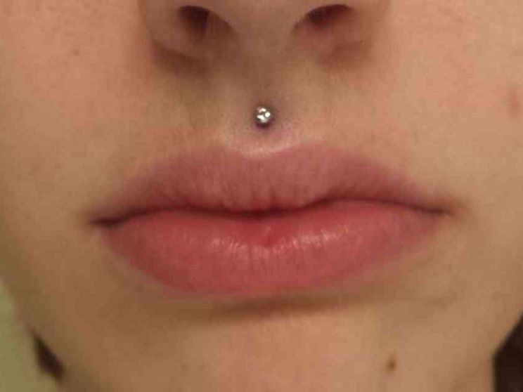 Va di moda il piercing, il Bambino Gesù: «Attenti ai rischi»