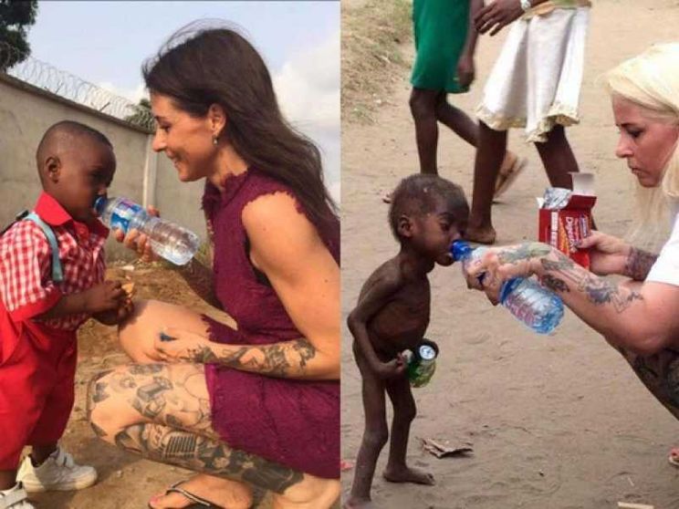 Ecco com'è rinato Hope, il bimbo condannato a morte dalla nascita