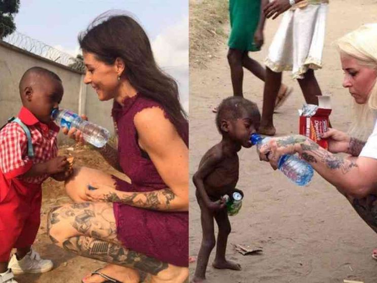 Ecco com'è rinato Hope, il bimbo condannato a morte dalla nascita