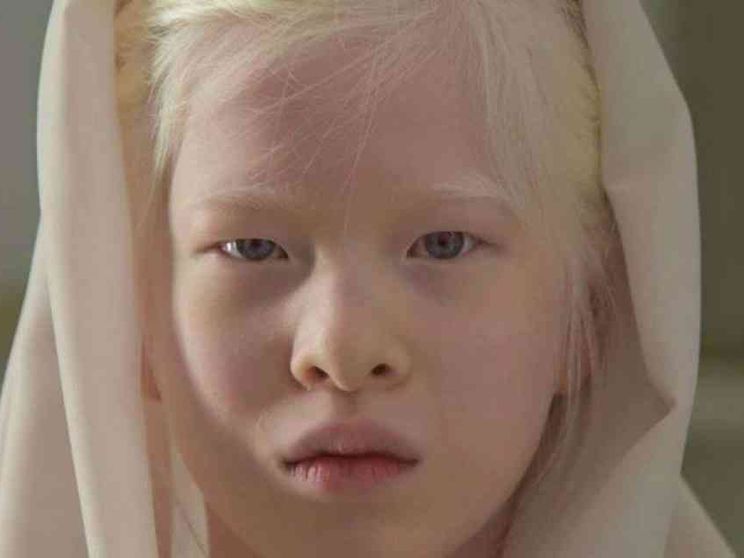 Xueli, la bambina albina abbandonata diventa modella