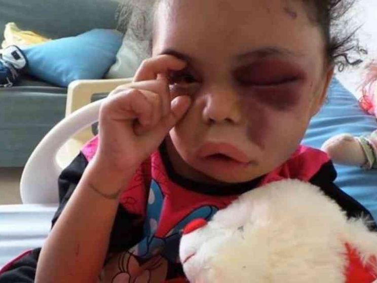 La piccola che apre gli occhi al mondo sulla guerra in Yemen