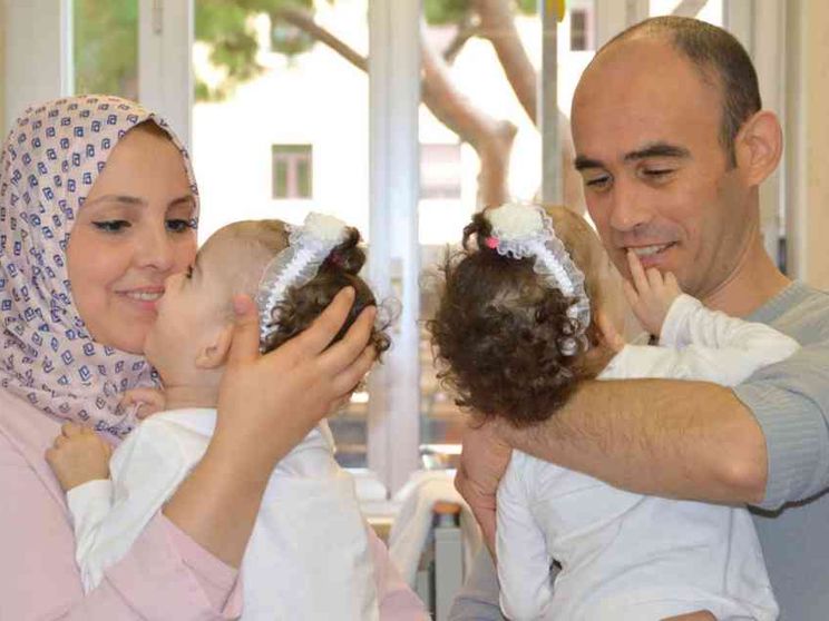 Separate 2 gemelle siamesi algerine. «Grazie, papa Francesco»