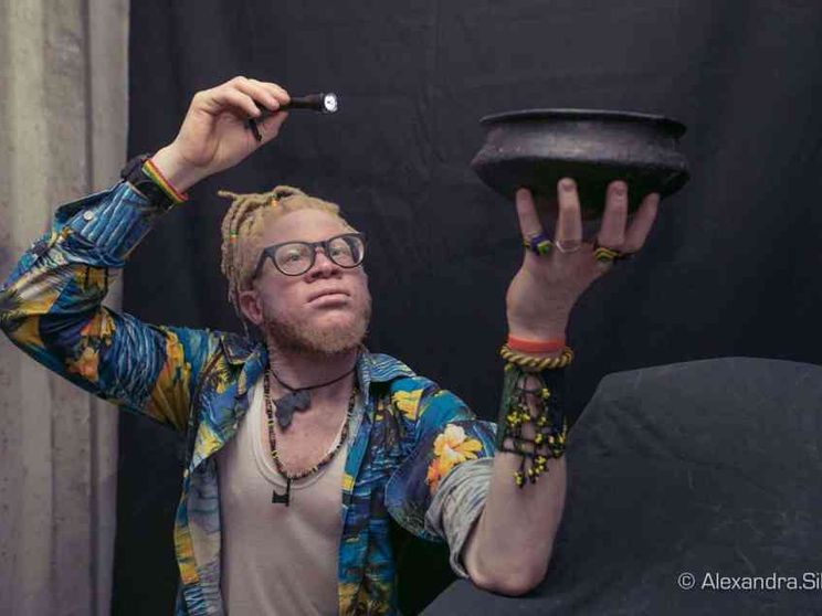 Gli albini «neri» che hanno successo, contro ogni superstizione