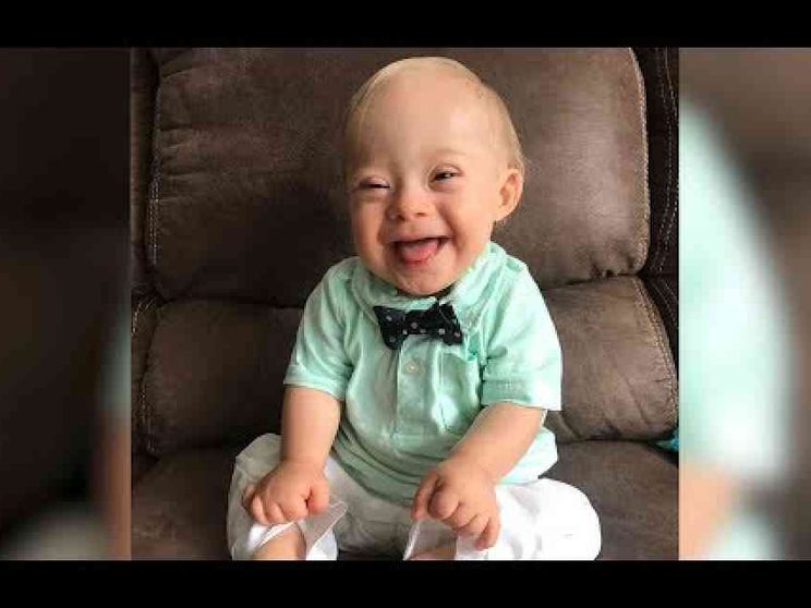 E Lucas, bimbo Down, diventa testimonial dell'anno