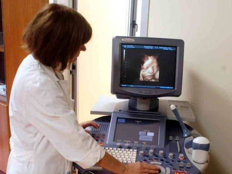 Aborti selettivi, caso a Treviso. «Neonati Down spariti»