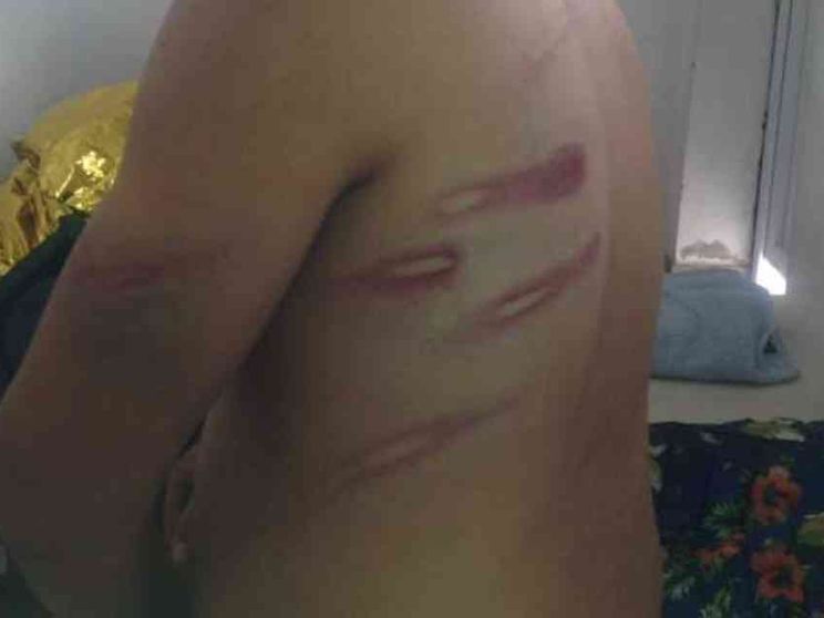 «Violati i diritti umani dei migranti nei centri di Lampedusa e Potenza»