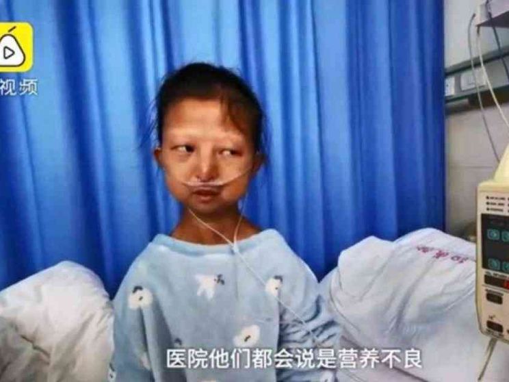 L'agonia di Wu Huayan morta di denutrizione per curare il fratello disabile