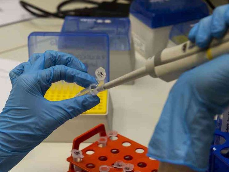 «Non è la peste, ma neanche l'influenza. Ecco perché»