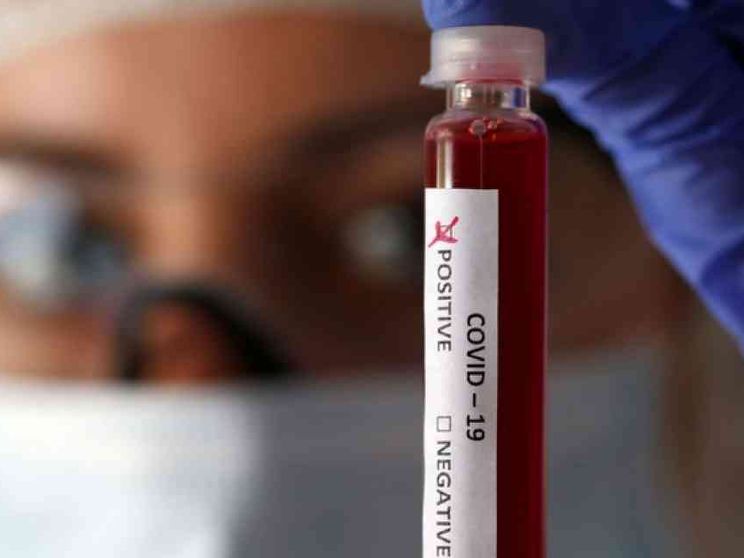 Ecco come gli antivirali e gli antireumatoidi curano i contagiati