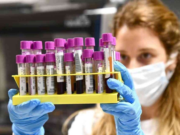 Guariti o dimessi? Ecco i segni che il Covid lascia (almeno per un po')