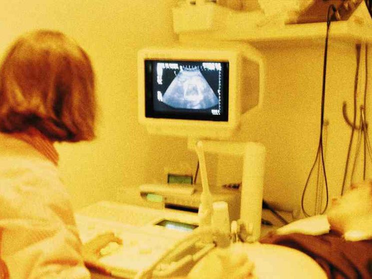 Aborti al minimo, crescono Ru486 e obiezione di coscienza