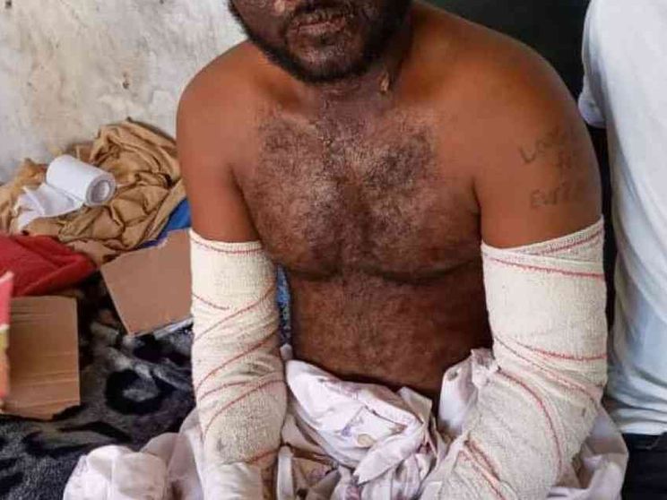 Ustionati in mare, la Libia li lascia "liberi". In carcere i sani