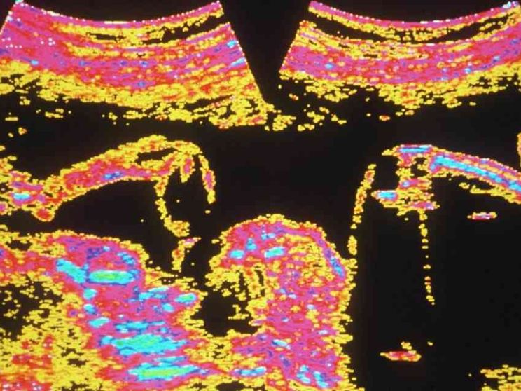 Francia: "diritto di abortire", colpo di mano in Parlamento