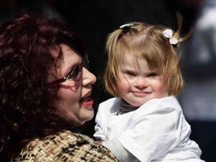 I 18 neonati Down «superstiti» dell’eugenetica danese