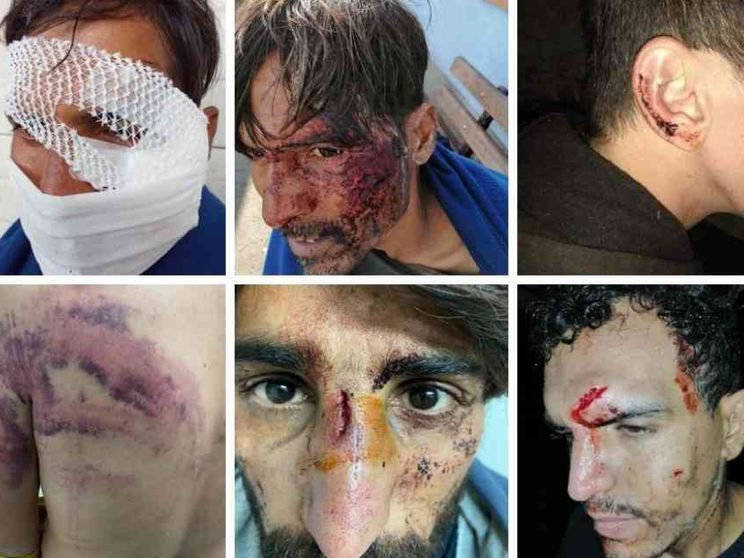 Sulla rotta balcanica delle migrazionI