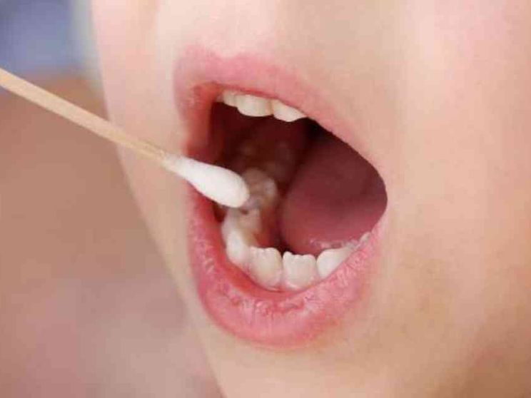 Milano, un bimbo di 4 anni con il Covid a novembre 2019