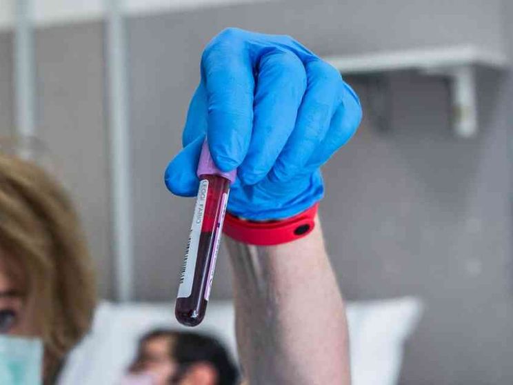 Il plasma giovane elisir per anziani?