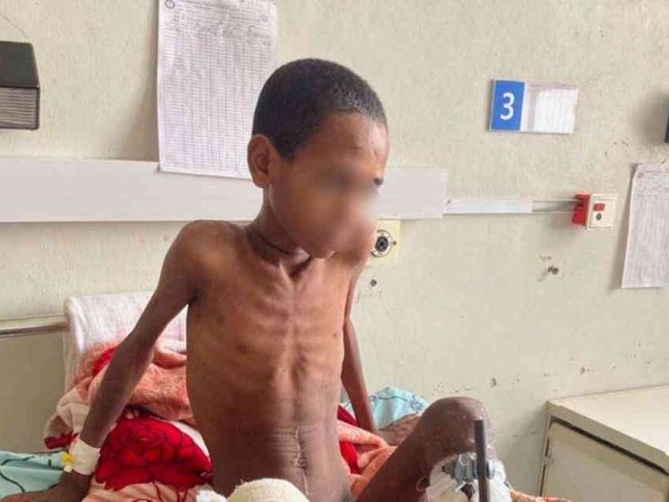 Sos dal Tigrai, aumentano le piccole vittime della fame