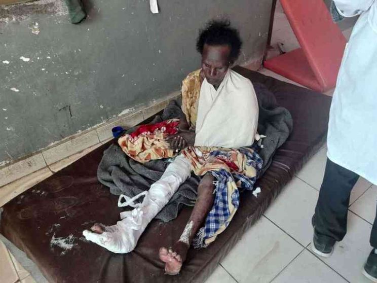 Droni contro un campo profughi, colpita anche una scuola. «56 morti»