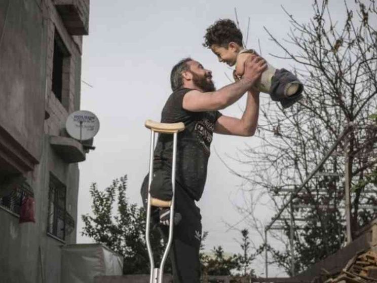 Padre e figlio senza arti in Italia: accolti dalla Caritas (Video)