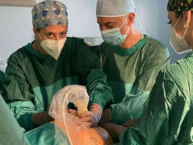 Fratellini operati in utero con successo alla 26esima settimana di gravidanza