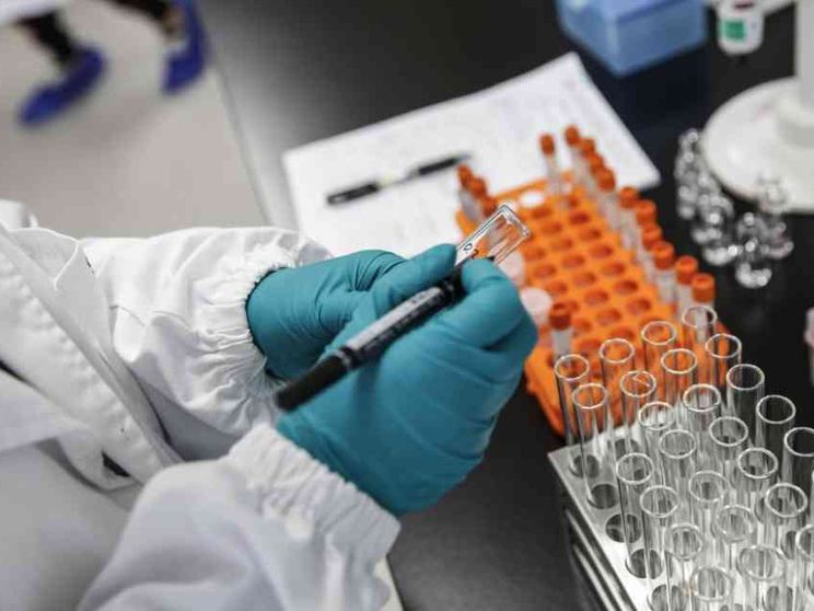 Così una "spia" rivelerà il cancro del polmone in tempo per guarire