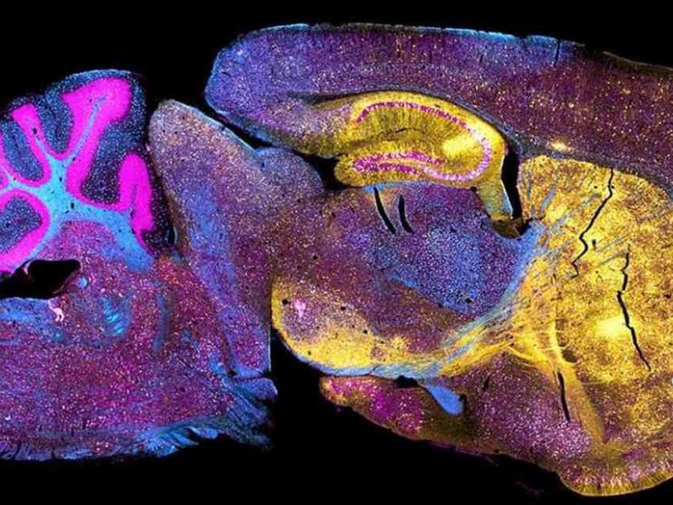 Chimere e organoidi che giocano: così si studia il cervello (con dubbi etici)