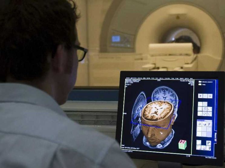 Malato di Sla parla grazie a un lettore collocato nel cervello