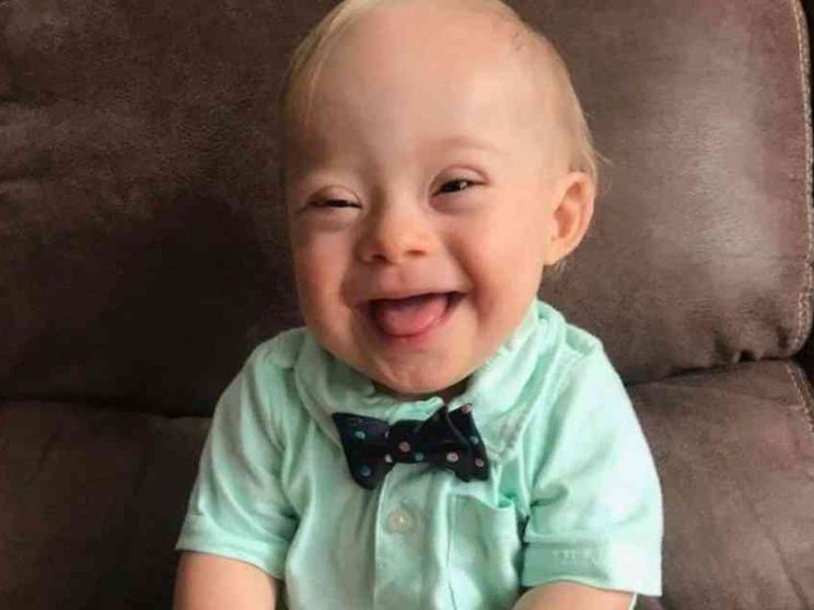 «Evitiamo la nascita di bimbi Down». E la mamma si ribella contro la Regione