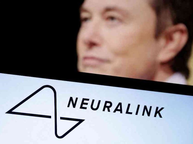 Un'azienda di Musk autorizzata a impiantare chip nel cervello