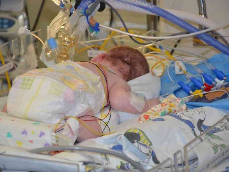 La bioingegneria ferma la spina bifida