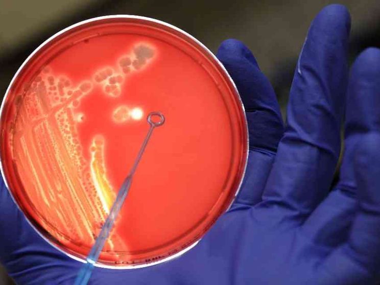 Un nuovo antibiotico contro il batterio killer