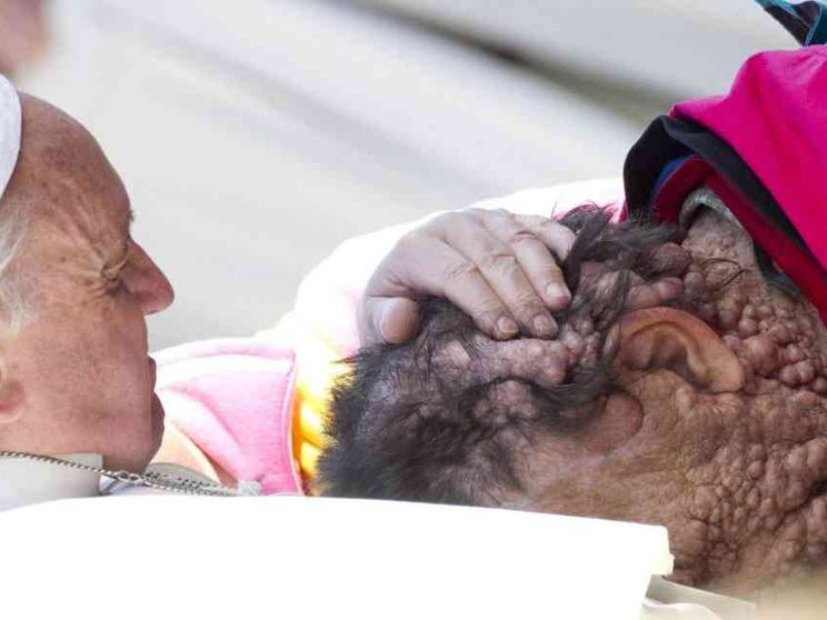 È morto Vinicio Riva, l'abbraccio con papa Francesco aveva commosso il mondo