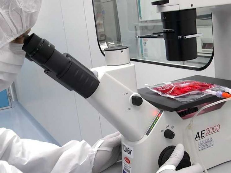 Cellule Car-T in ragazzi con gravi malattie autoimmuni: stanno bene