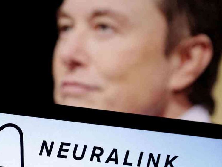 La sfida di Musk, fare “muovere” un tetraplegico con un chip nel cervello