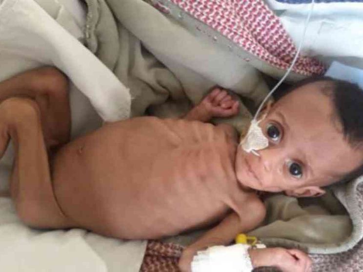 Tigrai 2024, la fame dimenticata: così muoiono in silenzio mamme e neonati