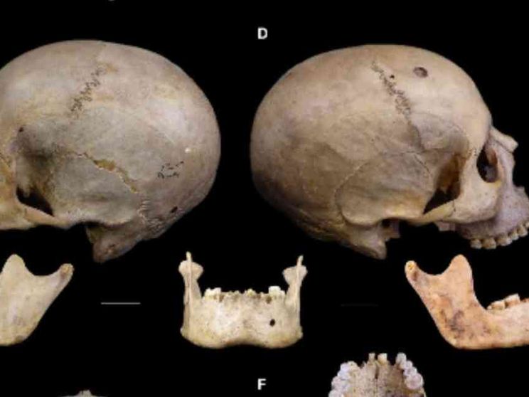 Il cancro era conosciuto nell'antichità e gli Egizi sapevano anche curarlo