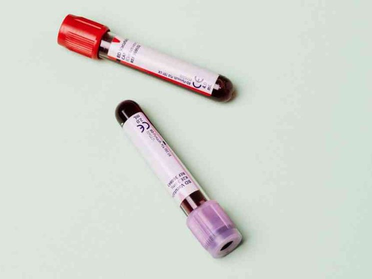 «Donazioni di sangue e plasma, mancano i medici per raccoglierle»