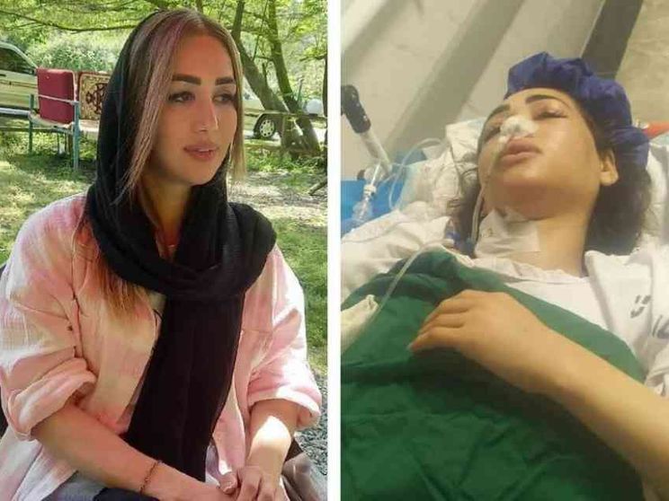 Donna viola la legge sul velo, la polizia spara e resta paralizzata