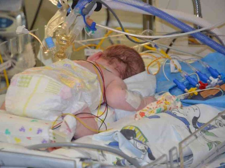 Il farmaco gratis, il Sud escluso, la rettifica: la bronchiolite è un caso