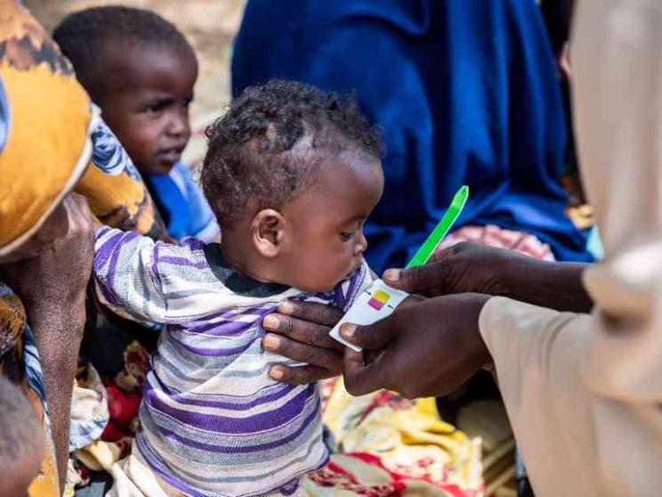 Quando la fame mangia i bambini: denutriti 27 milioni nel 2022. A Gaza il 96%