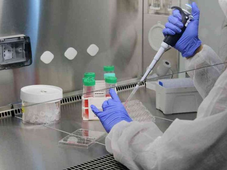 Speranze di cura per la forma genetica più comune di Sla